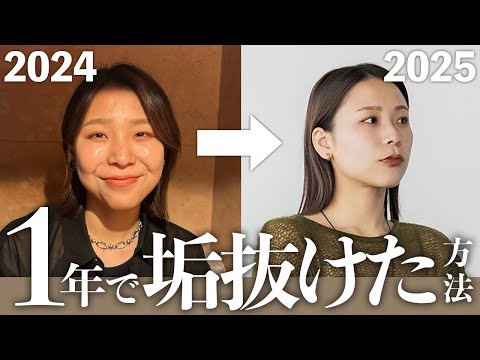 垢抜けのために課金して正解だったもの・微妙だったもの全部話す｜美容鍼、縮毛矯正、肌質改善、ホワイトニング サムネイル