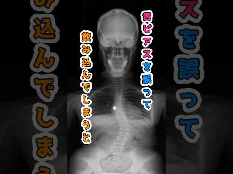 【実体験】舌ピアス飲み込んでしまった...対策！ サムネイル